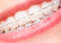 Aufmacherbild unpict - Fotolia.com Kopie Aufmacherbild unpict - Fotolia.com Kopie